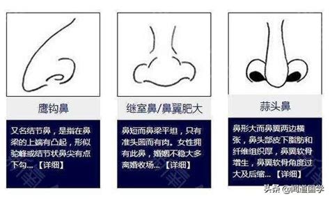 肉鼻子面相|面相學之鼻型解析、全面解讀鼻子與命運